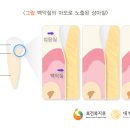 미듬치과 네이버블로그