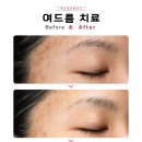 메디큐브의원 네이버블로그