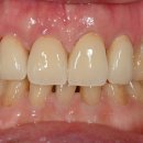 서울가족치과기공소 이미지