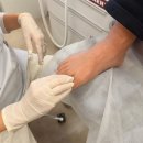 클린풋 | 대구 내성 발톱 관리 전문점 클린풋네일