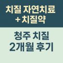 자연에서 얻은 참다운 삶 | 치질자연치료 + 치질약 사용한 청주치질 2개월 후기
