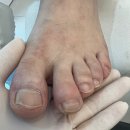 원동내성발톱 레푸스 오산중앙점 시원깔끔한 자기관리