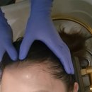 케어이십사 | 군산 소브라운지 군산두피케어 후기