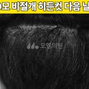 모엠의원 이미지