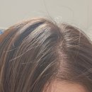 닥터K | 정수리숱 가는모발 고민 닥터웰리비 판토맥스, 테아로닌K 후기