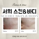 서희:스킨(서희:SKIN)