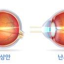 눈에빛안경콘택트 이미지