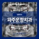파주운정치과, 양쪽 위 어금니가 없어서 식사하기 불편해요