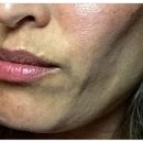 이승재의원 | 마곡동울쎄라 탄력 개선에는 ‘이것’이 핵심