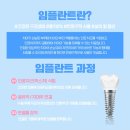 단원치과기공소 | 단원구치과 임플란트 안산치과 후기