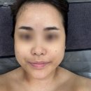신개금LG2차아파트 상가 앞 | 연산동피부관리 잘하는 벨리브뷰티에서 골드테라피로 피부컨디션 회복한 상세후기