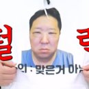 한미병원 | 한미성형외과 눈밑지방재배치(눈밑지방이동술) 수술당일 ~ 6일차 후기 / 내돈내산
