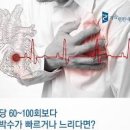 맥박이 느리면 맥박수 정상범위 서맥 운동 가능할까? 이미지