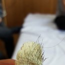 루디아피부비만관리