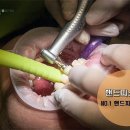 핸드피스닥터 이미지