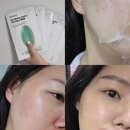 주식회사 닥터장솔루션 | 수부지/유수분밸런스 추천 | 닥터자르트 마스크팩 수딩 하이드라 솔루션 프로 내돈내산 솔직후기