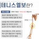 웰투데이 | 테니스 엘보 치료법 됐습니다