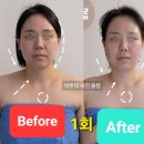윤곽