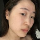 오영아샵 | 오산피부관리샵 '라보떼에스테틱' 2회차 후기