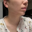 라인메디텍 이미지