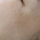 유니드케어 이미지