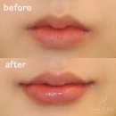 르에이치의원 이미지