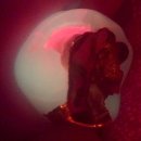 정치과의원 | 📸오류동 바른정치과, 충치와 실금을 잡는 큐레이(Q-ray) 장비📸