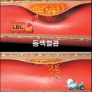 나쁜 콜레스톨 내리기 이미지