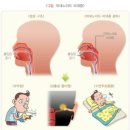 J35 편도 및 아데노이드의 만성 질환 Chronic diseases of tonsils and adenoids 이미지