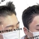 시선을즐기다탈모두피커버헤어라인전문부산점 이미지