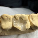 설 치과기공소 이미지