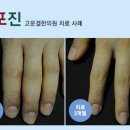 한방피부과학연구소 네이버블로그