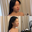 용산-69 | 용산윤곽관리 추천 온화에스테틱 후기