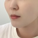 인천메디 | 부평에스테틱 데자뷰메디스킨 인천점 수분초음파 후기