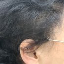 복음보청기 성남센터 | 복음보청기 성남센터 방문 후기: 만족스러운 보청기 수리 경험