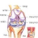 추벽증후군 원인 수술 예방 이미지