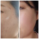 H1004 | 🤫 에스테틱 언니들의 찐템은 바로 요거! 피부 뒤집어졌을 땐 아말다 부활 클렌징! ✨