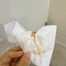 상봉마리아 시험관 동결1차 5일배아 인공주기 배아이식 출혈