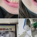 목동크라운치과의원 이미지