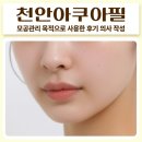 데이봄의원 | 천안아쿠아필 모공관리 목적으로 사용한 후기 의사 작성