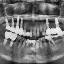수원탑플란트치과의원 이미지