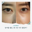 서울라인성형외과의원 이미지