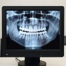 세이브치과의원 | 치과 공포증? 이제 쌉가능입니다!