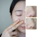 윤스스킨닥터 | 닥터디퍼런트 레티날 크림 비타아크날 모공 한달 관리 찐후기
