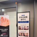 엄지약국 | 인천 송도 심한 엄지발톱무좀 문제성발톱병원에서 레이저 치료 후기
