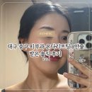 줄 | 대구 온다리프팅 성지 8만줄 솔직후기 (전후사진 O)