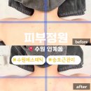 경기도 수원시 팔달구 장다리로195번길 34 (인계동) | 일자어깨 만들어주는 인계동 피부정원 등관리 승모근관리 어깨 비대칭 교정