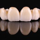 판치과기공소 이미지