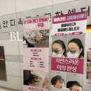 블룸SMP본점에서 두피스케일링 받기