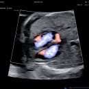 짱아 | [임신 21주차 일기] 정밀초음파 후기 + 첫 태동! 드디어 짱아의 움직임을 느낀 날💛